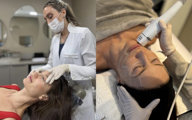 Júlia Pereira aposta em estética preventiva e escolhe clínica de Porto Alegre para cuidados faciais com foco na naturalidade