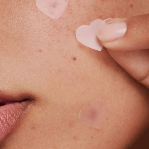 Especialistas em pele dão dicas para remover marcas de acne.