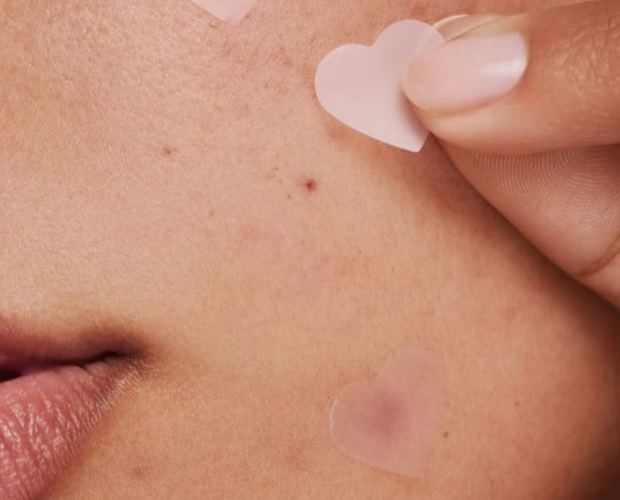 Especialistas em pele dão dicas para remover marcas de acne.